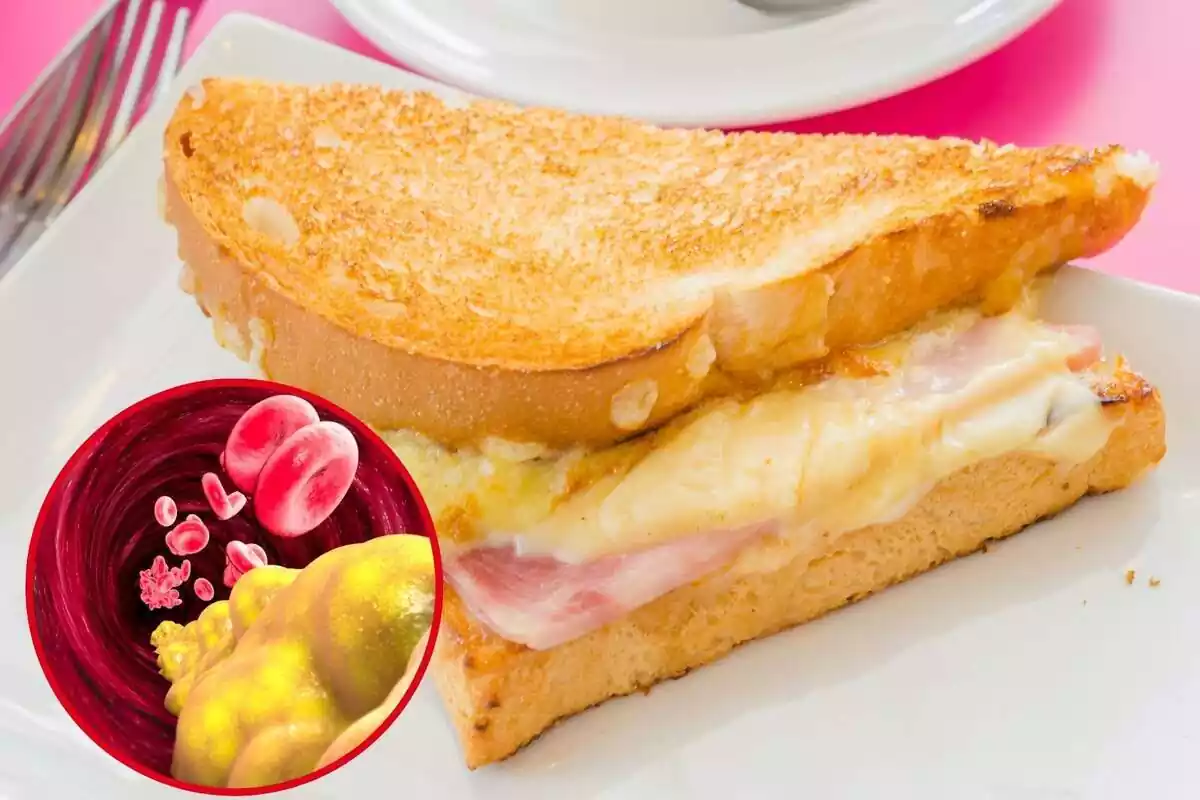 Sándwich de jamón y queso con una imagen destacada a la izquierda de colesterol en sangre
